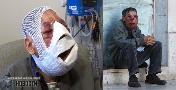 Самые странные объекты, выраставшие в человеческом теле
